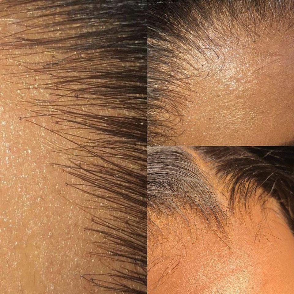 BAISI 4*4 HD Closure Perruque Lisse Couleur Noir Lace Invisible Effet Très Naturel Perruque de Luxe Facile A Porter En 100% Cheveux Humains